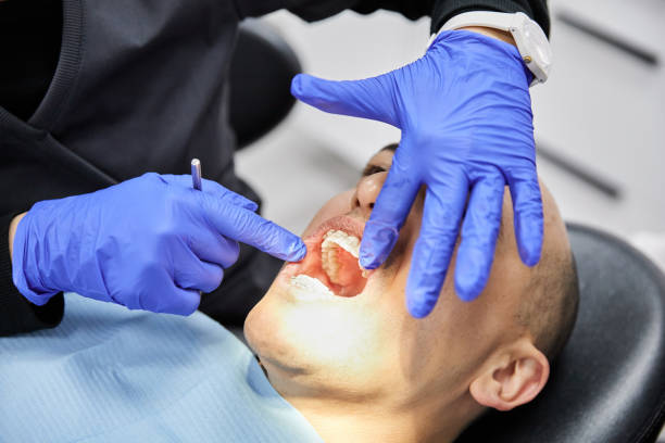 Best Emergency Dentist for Knocked-Out Tooth in Fairlawn, OH